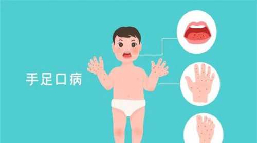广州代生中介费用,试管婴儿为什么会胎停-广州南方医院生殖中心做试管婴儿怎