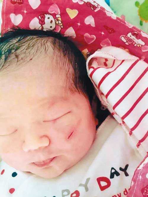 惠州国内借卵生子 惠州试管婴儿成功率 ‘孕囊1.8*2.0*1.3是男是女孩’